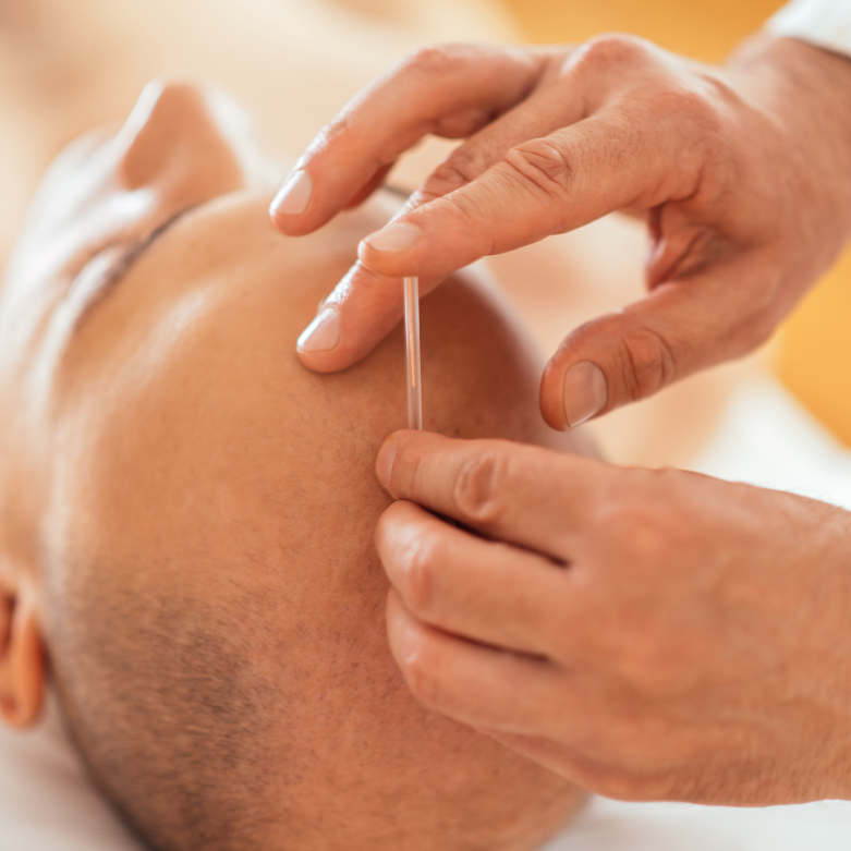 Expert acupuncture care